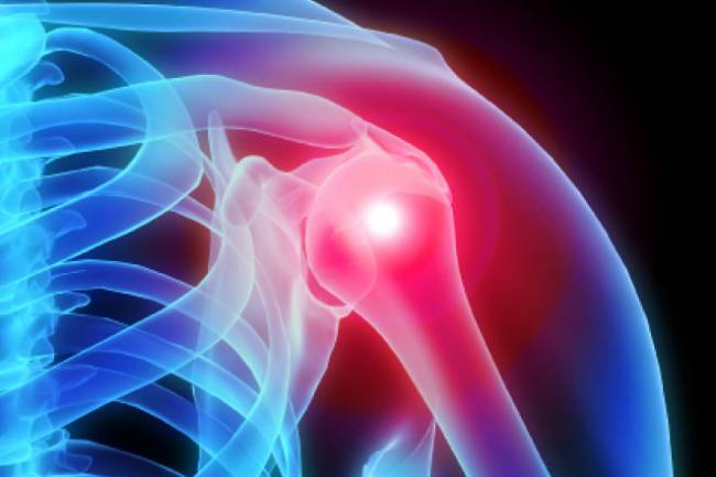 Most Common Joint Problems