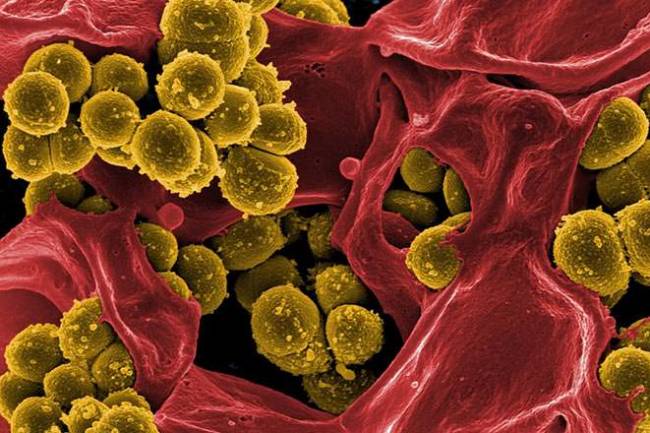 Mucus And The Meaning Of Different Colours