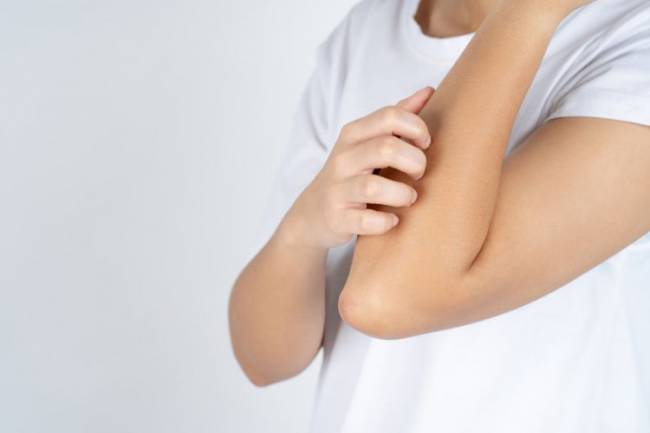 Top Supplements for Itchy Skin